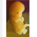 Harvard Law Journal Concludes Unborn Babies Have Constitutional Rights