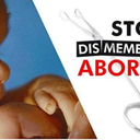 Texas Gov. Signs Bill Banning Dismemberment Abortions