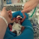 U.S. Senate votes against protecting pain-capable preborn children