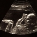 33 States Have Passed 479 Pro-Life Laws in the Last 10 Years Protecting Babies From Abortion