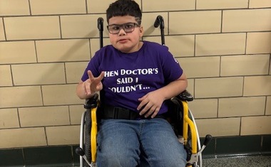 CELEBRATING MOEBIUS SYNDROME AWARENESS DAY