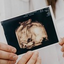 We Are All Humans, from Conception to Natural Death