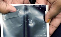 'A Modest Proposal': Let us promote life in all its beauty