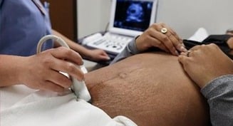 Los defensores de personas con síndrome de Down piden a los católicos que ayuden a los padres