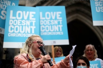 Abortions of unborn babies diagnosed with Down syndrome up 82% in Scotland