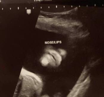 Bosco Joseph Paul Cooper, Stillborn April 20, 2021