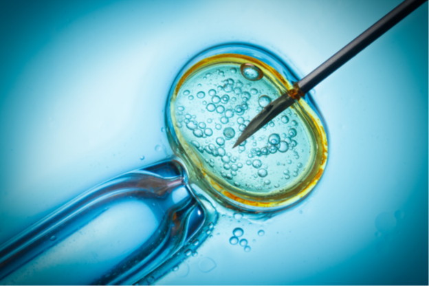 In Vitro Fertilization