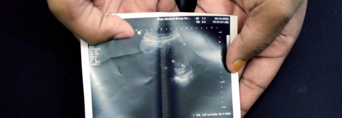 'A Modest Proposal': Let us promote life in all its beauty